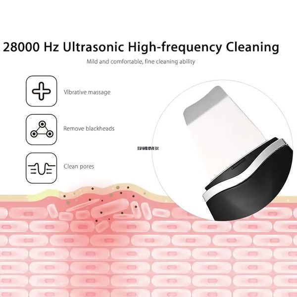 Ультразвуковий скрабер для чищення обличчя Ultrasonic Beauty Home Black 1355 фото